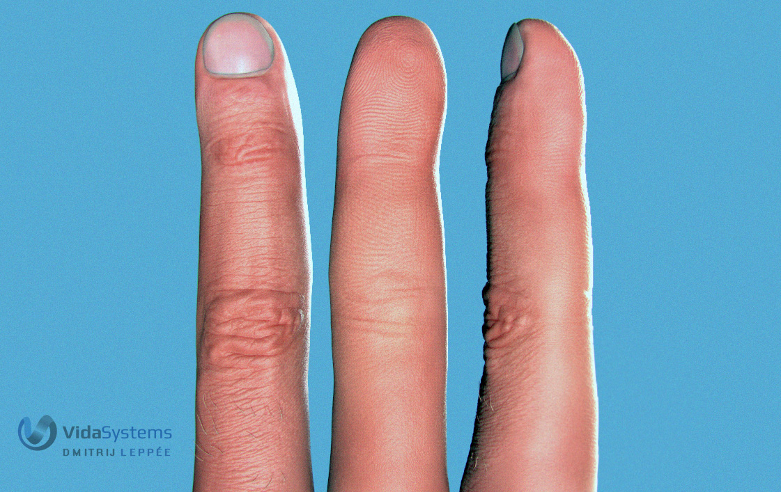 Vida_finger.jpg