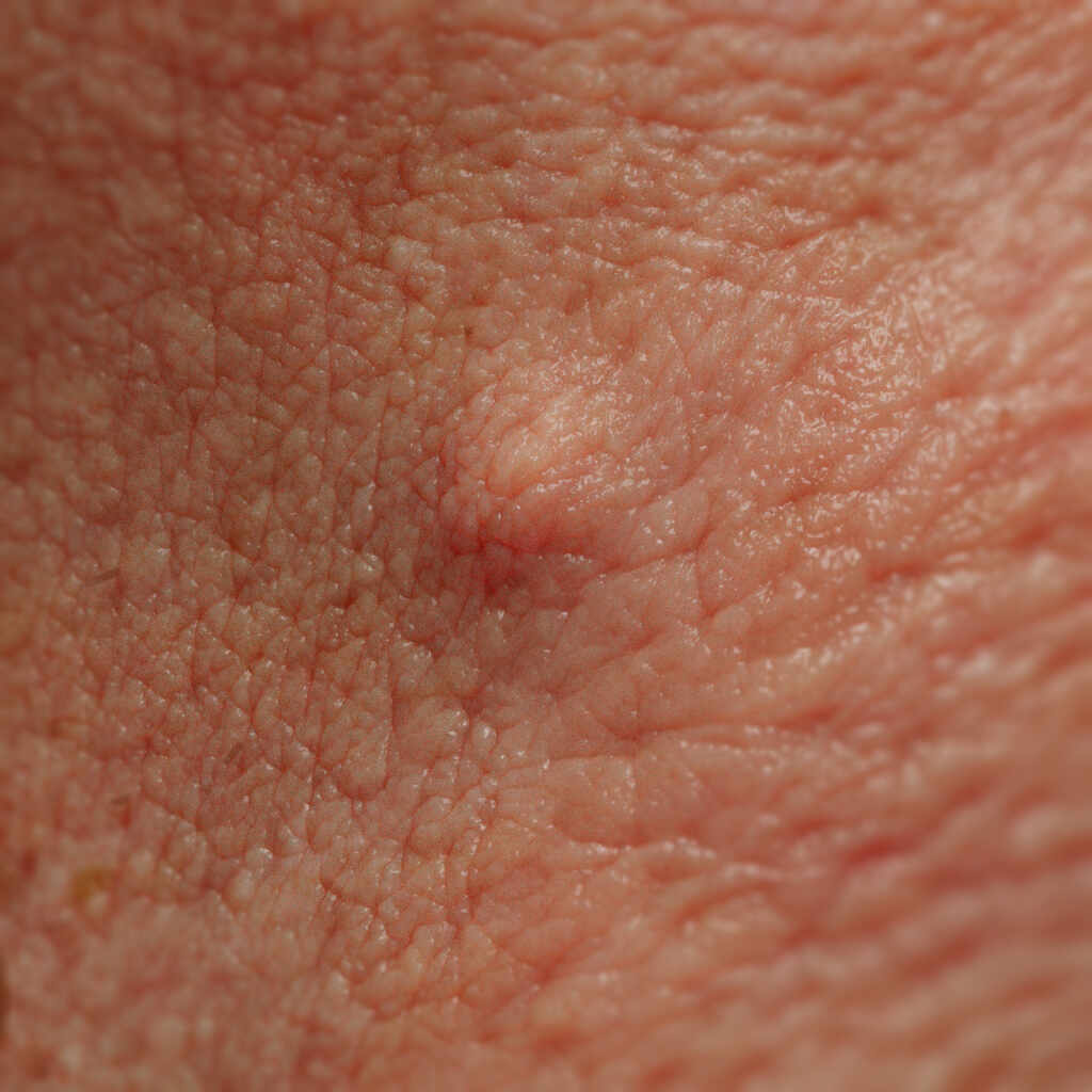 moleeeeeeeeeeeeee222