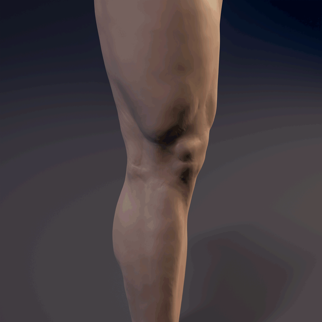 Leg_Straith_Cam_03_shot