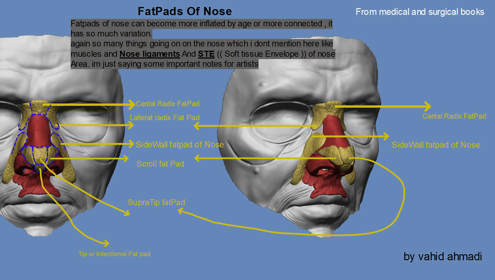 FatPads Of nose by vahid ahamdi