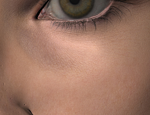 EyeSkinClose.jpg