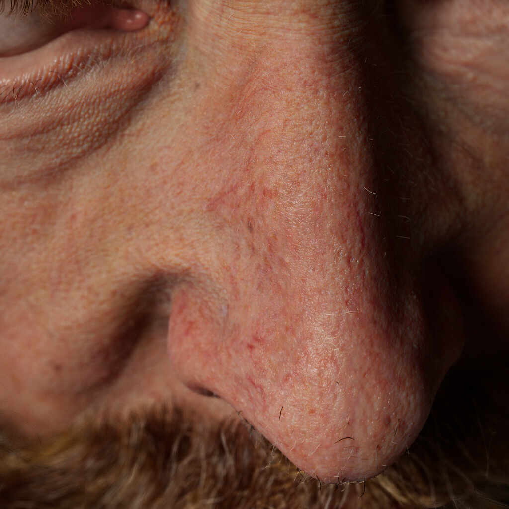 peter rubens nose by vahid ahmadi