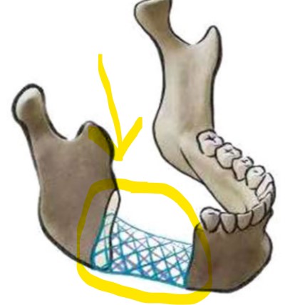 a3a1cb2fd0845a90ea9b1c65970d1f6accb4a92c