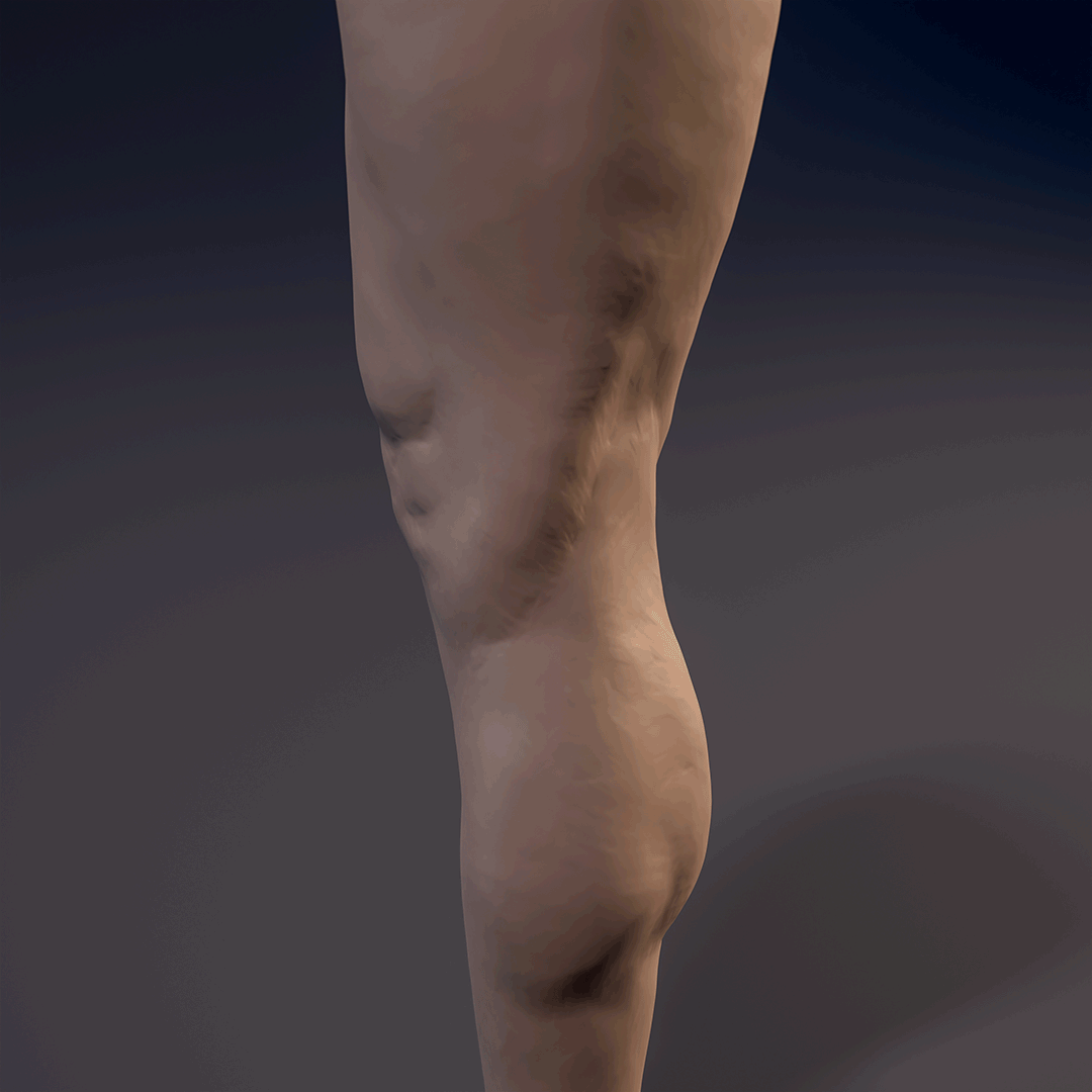 Leg_Straith_Cam_04_shot